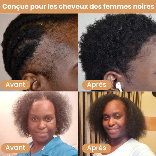 Huile de croissance de cheveux