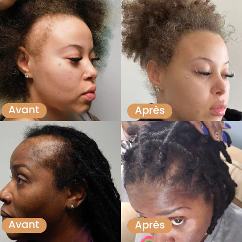 Huile de croissance de cheveux