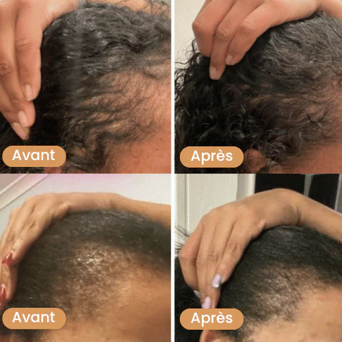 Huile de croissance de cheveux
