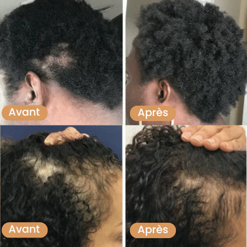 Huile de croissance de cheveux